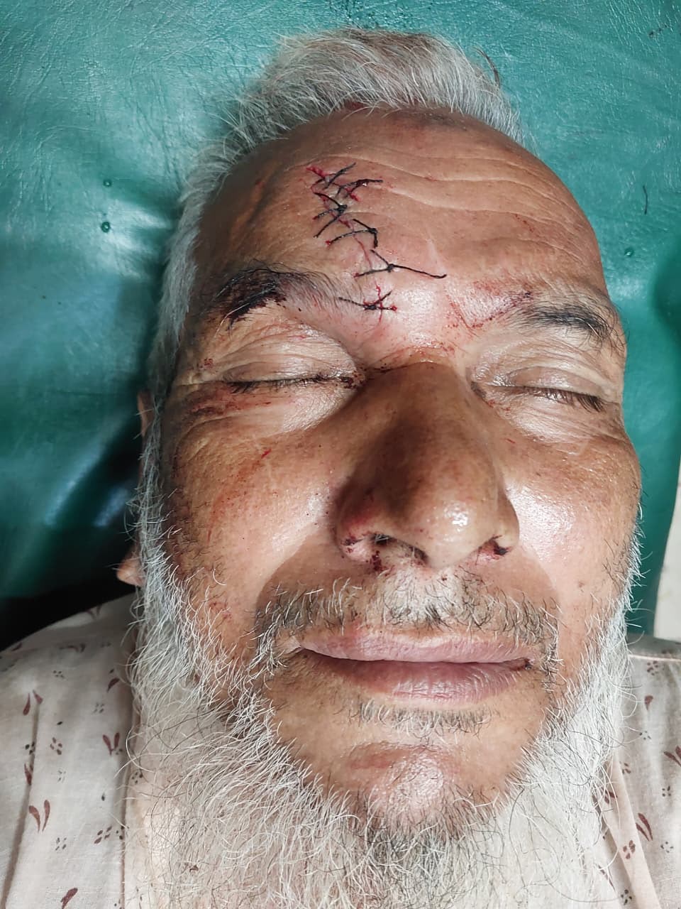 নবীনগরে ড্রেজার দিয়ে মাটি কাটার প্রতিবাদ করায় বৃদ্ধকে দা দিয়ে কোপানোর অভিযোগ, থানায় মামলা
